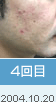 4���