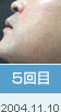 5���