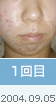 1���