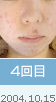 4���