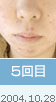 5���