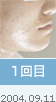 1���