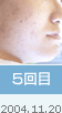 5���