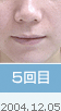 5���